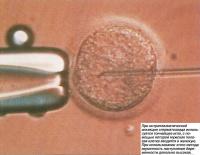 При интраплазматической инъекции сперматозоида используется тончайшая игла