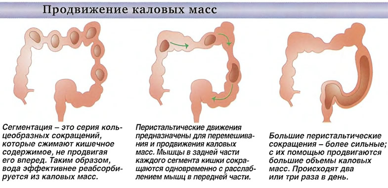 Диета При Каловых Камнях В Прямой Кишке