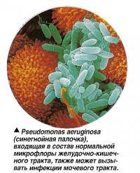 Pseudomonas aeruginosa (синегнойная палочка)