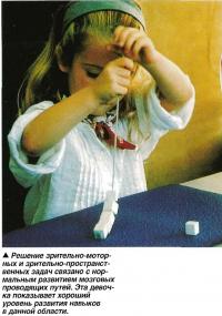Решение зрительно-моторных и зрительно-пространственных задач