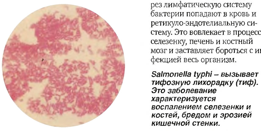 Salmonella typhi - вызывает тифозную лихорадку (тиф)