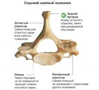 Седьмой шейный позвонок