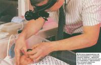 Сетчатка недоношенных детей осматривается с помощью глазного зеркала