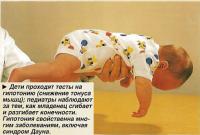 Тест на гипотонию