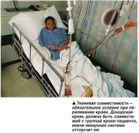 Тканевая совместимость