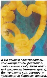 Толстый кишечник (желтого цвета)
