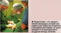 Торакотомия - проводится для закрытия отверстия в висцеральной плевре