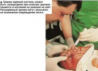 Травма нервной системы может быть заподозрена при осмотре зрачков пациента
