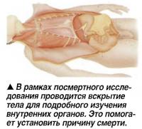 В рамках посмертного исследования проводится вскрытие тела для изучения внутренних органов
