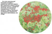 Вирусы ВИЧ (красные) атакуют белую кровяную клетку Т-лимфоцит (зеленая)