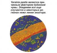 Yersinia pestis является причинным фактором бубонной чумы