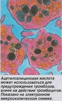 Ацетилсалициловая кислота может использоваться для предупреждения тромбозов