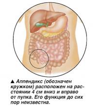 Аппендикс расположен на расстоянии 4 см вниз и вправо от пупка