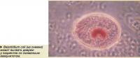Balantidium coli (на снимке) может вызвать диарею у пациентов со сниженным иммунитетом