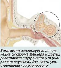 Бетагистин используется для лечения синдрома Меньера