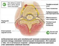 Безопасная зона для люмбальной пункции