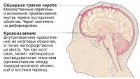 Более крупные ударные повреждения