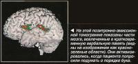 Части мозга, вовлеченные в кратковременную вербальную память