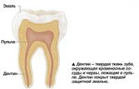 Дентин - твердая ткань зуба, окружающая кровеносные сосуды и нервы