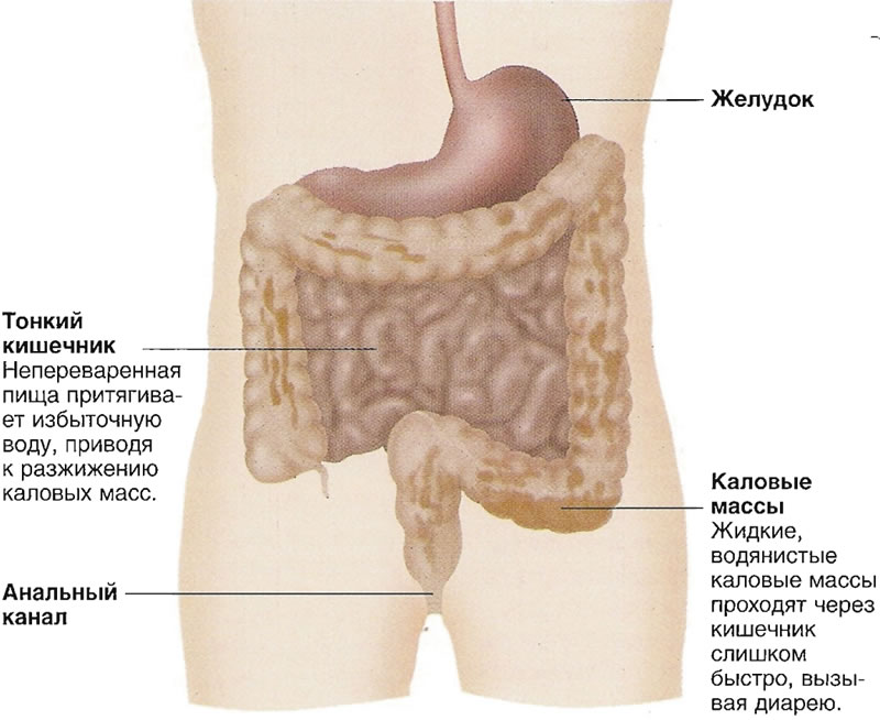 Диарея — ключевой симптом. Причина: нарушение переваривания пищи в тонком кишечнике