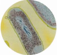 Дизентерию вызывает бактерия Shigella. Симптомы: кровавая диарея, лихорадка, головная боль