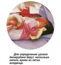 Для определения уровня билирубина берут несколько капель крови из пятки младенца