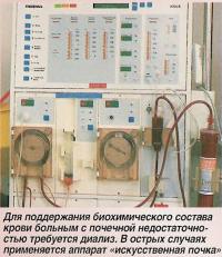 Для поддержания биохимического состава крови больным с почечной недостаточностью требуется диализ