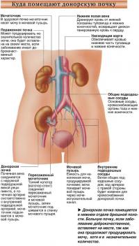 Донорская почка помещается в нижнем отделе брюшной полости