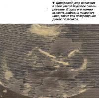 Дородовой уход включает в себя ультразвуковое сканирование