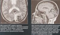 Два снимка МРТ вверху сделаны в поперечной и в боковой проекциях