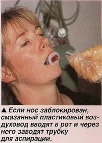 Если нос заблокирован, смазанный пластиковый воздуховод вводят в рот
