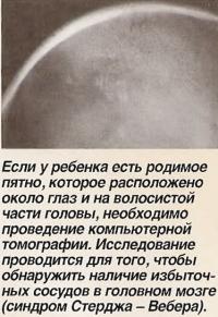 Если у ребенка родимое пятно около глаз необходимо проведение компьютерной томографии