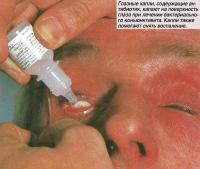 Глазные капли, содержащие антибиотик, капают на поверхность глаза
