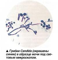 Грибки Candida (окрашены синим) в образце мочи под световым микроскопом