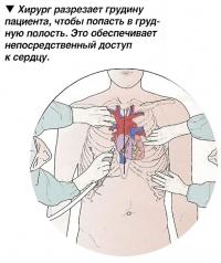 Грудная полость