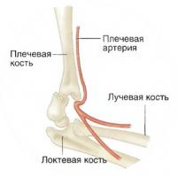 Хорошо видно расположение костей локтя и плечевой артерии