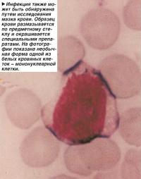 Инфекция также может быть обнаружена путем исследования мазка крови
