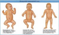 Изменение пропорций тела ребенка