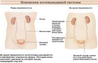 Изменения мочевыводящей системы