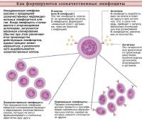 Как формируются злокачественные лимфоциты