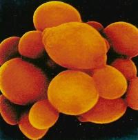 Кандидоз влагалища (Candida albicans на фото) хорошо поддаётся антимикотической терапии
