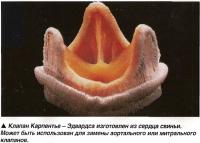 Клапан Карпентье - Эдвардса изготовлен из сердца свиньи