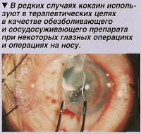 Кокаин используют при некоторых глазных операциях и операциях на носу