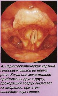 Ларингоскопическая картина голосовых связок во время речи