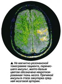 Магнитно-резонансная томограмма пациента