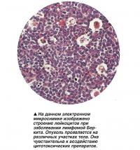 На данном микроснимке изображено строение лейкоцитов при заболевании лимфомой Беркита