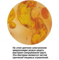 На этом микроснимке можно видеть бактерии Campylobacter jejuni