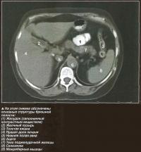 На этом снимке обозначены основные структуры брюшной полости