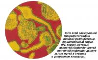 На этой электронной микрофотографии показан респираторносинцитиальный вирус