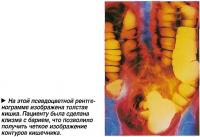 На этой псевдоцветной рентгенограмме изображена толстая кишка.